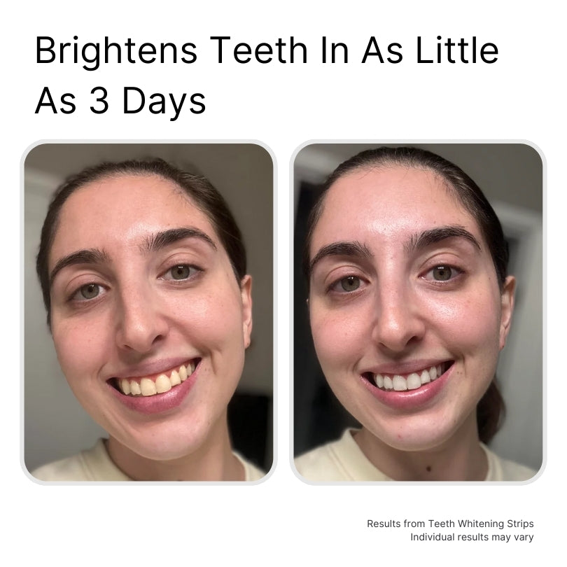 5D Diamond Whitening Strips